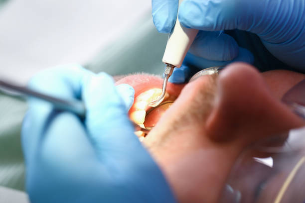 Best Emergency Orthodontic Repairs in Moorpark, CA