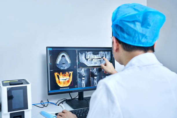 Best Emergency Tooth Extraction in Moorpark, CA