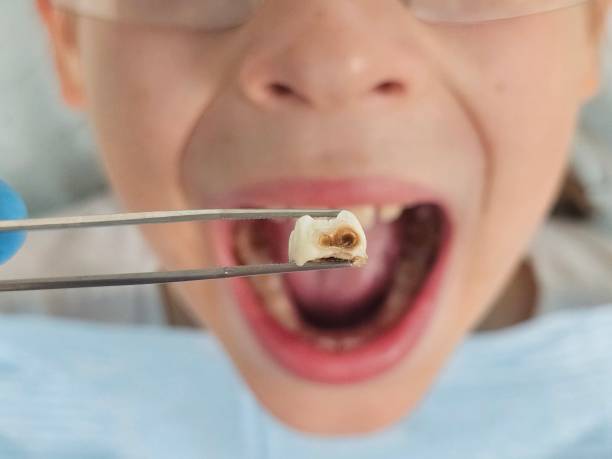 Best Walk-In Emergency Dentist in Moorpark, CA